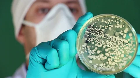 Scientist counts microbial colonies in laboratory on the face background Stock Footage 73552226