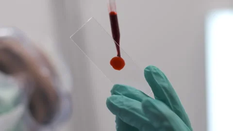 Scientist dripping blood sample research in laboratory, microbiology test Видео 133067843