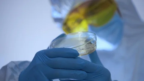 Scientist examines and opens Petri dish with bacteria. Stock Footage 106216819