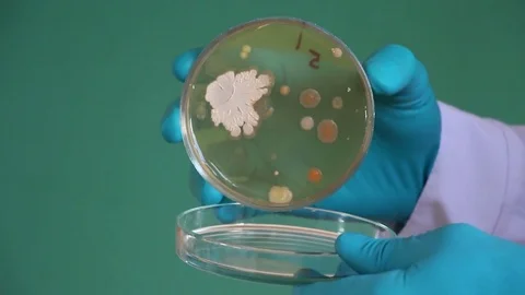 Scientist examines the petri dish Stock Footage 73170758