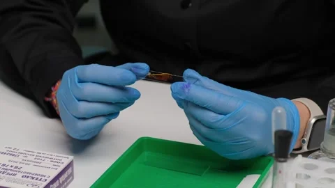 Scientist Examining Stained Microscope Slide Stock Footage 303369558