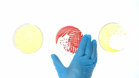 Scientist hand remove colony of bacteria on nutrient media in petri dish Stock Footage 233362048