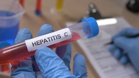 Scientist Holding a Hepatitis C Test Tube While Taking Notes in Laboratory 스톡 동영상 77111134