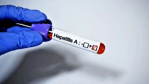 Scientist holding a Positive Hepatitis A test tube. white background Stock Footage 307314958