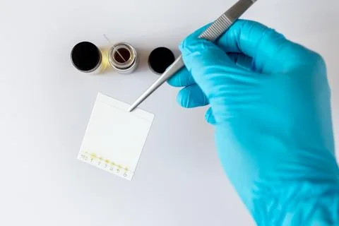 Scientist Holding Spotted Sample TLC Plate with Forceps Stock Photos