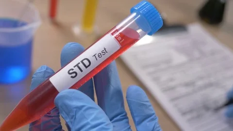 Scientist Holding a STD Test Tube While Taking Notes in Laboratory Stock Footage 77111310