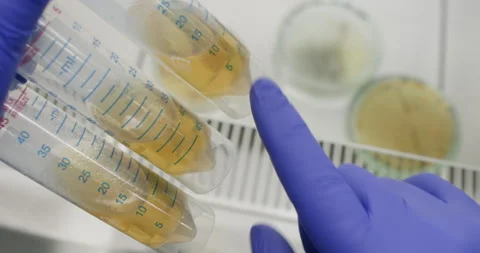 Scientist holding three large test tubes with yellow transparent liquid Stock Footage 317435247