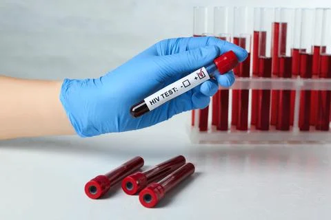 Scientist holding tube with blood sample and label HIV Test at white table, c Stock Photos