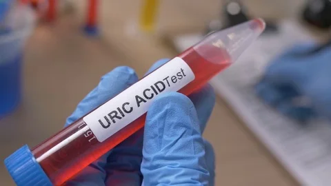 Scientist Holding an Uric Acid Test Tube While Taking Notes in Laboratory Stock Footage 77111747