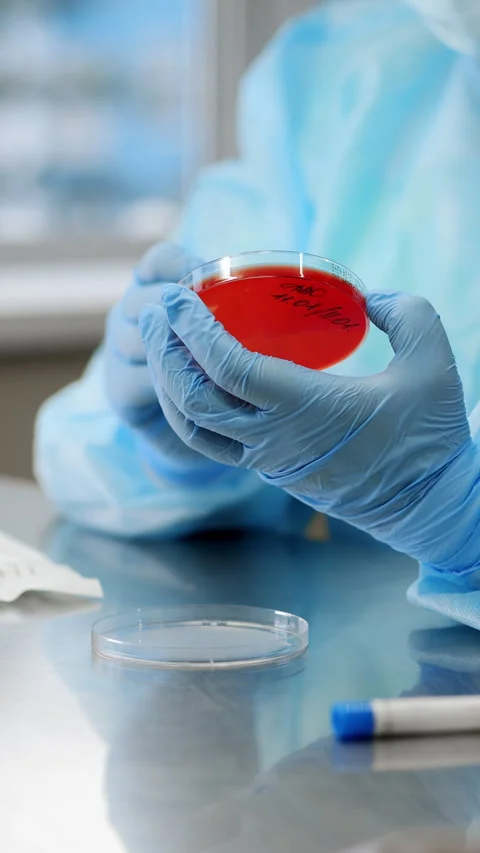 A scientist inoculates a patients sample onto a petri dish. Stock Footage 314343166