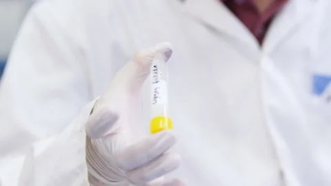 Scientist in lab coat and rubber gloves flips test tube Stockbeeldmateriaal 182546599