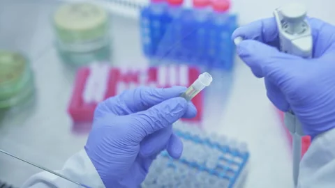 Scientist in the laboratory takes sample of yellow liquid from test tube with Stock Footage 161887695
