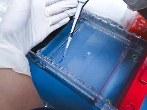 Scientist Loading DNA Samples into Agarose Gel Wells Using Micropipette Stock Photos