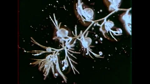 A scientist looks under a microscope to observe how small insects get eaten by 库存影片 102502896