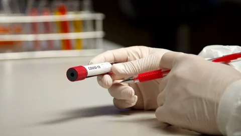 Scientist marking COVID-19 test tube Stock Footage 127560200