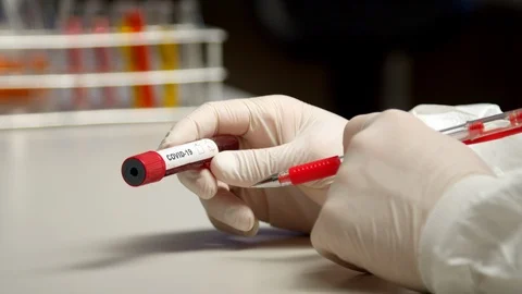 Scientist marking COVID-19 test tube Stock-Footage 127560427