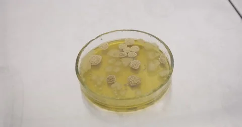Scientist opens a petri dish with bacteria Video stock 172487740