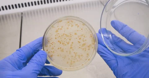 A scientist opens a petri dish 動画素材 172166387