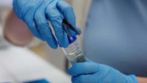 Scientist opens test tube and pull out sample of dragonfly Stock Footage 305257256