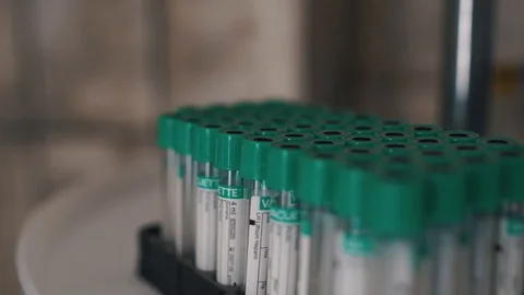 A scientist with a pipette analyzes a colored liquid to extract the DNA and Stock Footage 112142363