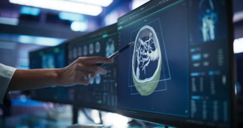Scientist Pointing At Brain Scan On Computer Screen Stock Footage 256037139
