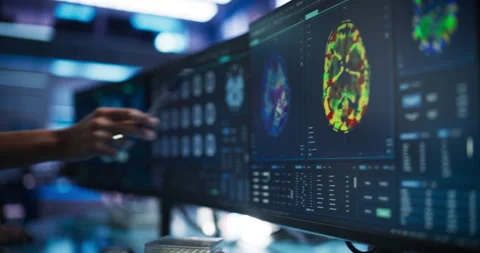 Scientist Pointing At Brain Scan On Computer Screen Stock Footage 256037162