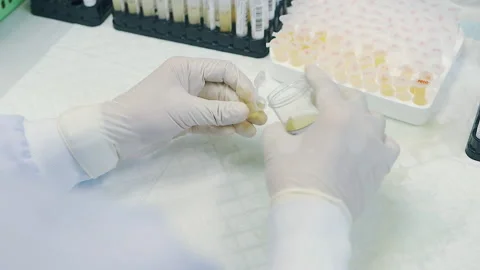 Scientist pour yellow solution from bottle to plastic tube in laboratory Stock-Footage 158528722