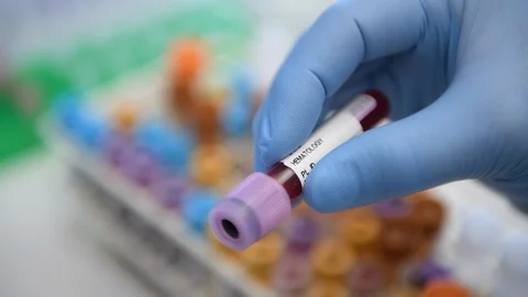 Scientist preparing blood sample for testing in the laboratory Stock Footage 129901841