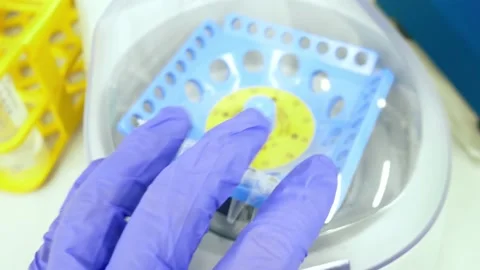 Scientist puts the test tubes in centrifuge. Automation in the clinical Stock Footage 150973243