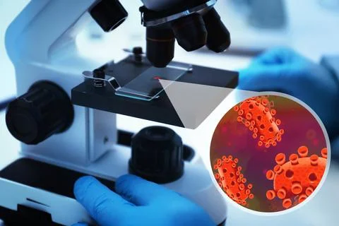 Scientist studying monkeypox virus under microscope at laboratory, closeup Stock Photos