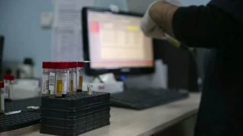 Scientist testing blood samples in laboratory Stock Footage 23339986