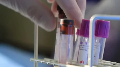 Scientist using eye dropper Stock Footage 20446774