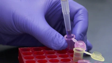 Scientist using pipette to fill multiwell plate for analysis Stock-Footage 93524406