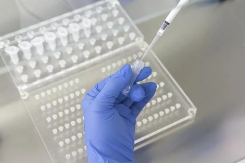 Scientist working with blood sample in laboratory.A blood test result for the Foto stock