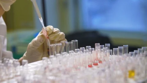 Scientist working with blood samples in laboratory. Close up Stock Footage 72565798