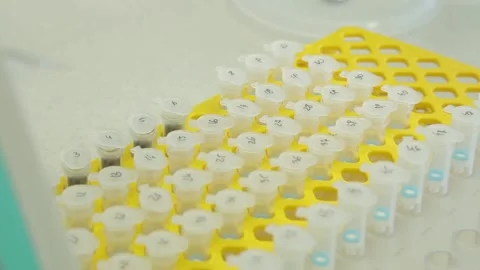Scientist working in the laboratory with DNA and blood Stock Footage 136400604