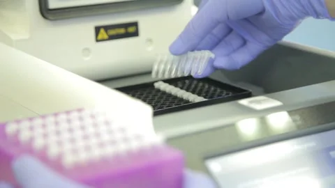 Scientist working in the laboratory with DNA and blood Stock Footage 136400836
