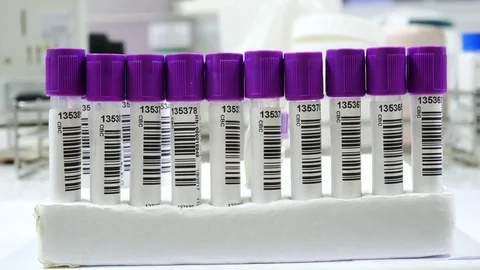 Scientist working in laboratory staining CBC Stock Footage 79136236