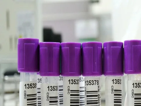 Scientist working in laboratory staining CBC Stock Footage 79136241