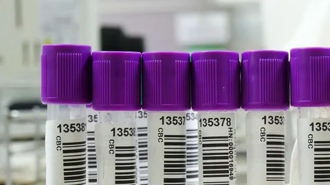 Scientist working in laboratory staining CBC Stock Footage 79137193