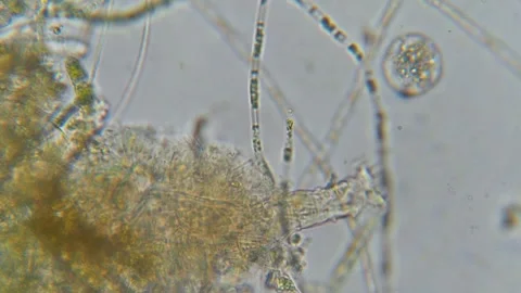 Scientists Examine Soil Microorganisms Hidden Life Beneath Our Feet Stock Footage 323779290