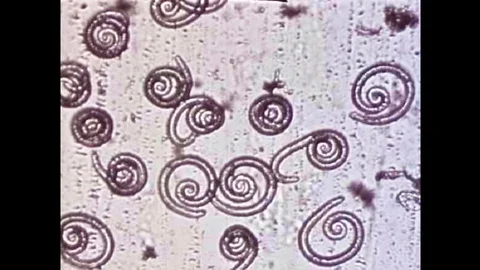 A scientists looks at digested pork under a microscope to check for the parasite Stock-Footage 101310852