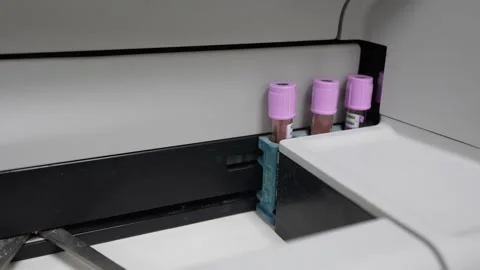 Scientists tested with automated hematology analysis. Video stock 237212844