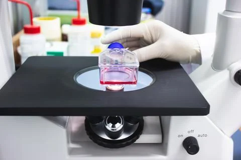Scientists use a microscope to look at cultures of cancer cells in the labo.. Stock Photos