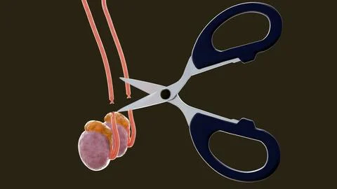 Scissors cutting off the vas deferens tubes Stock Illustration