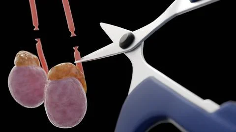 Scissors cutting off the vas deferens tubes Stock Illustration