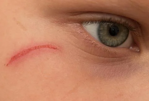 Scratch on the face Stock Photos