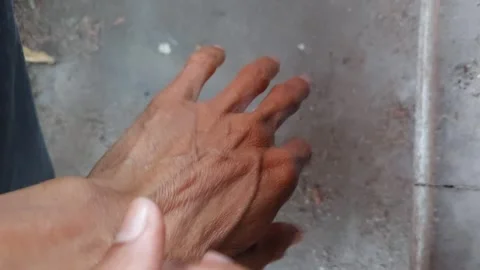 Scratch your hand and apply powder Stock Footage 262628326