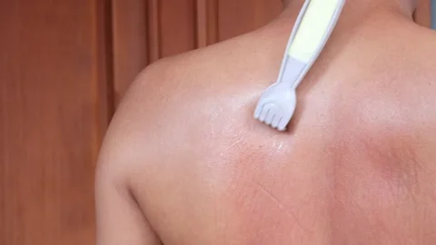 Scratches his back Видео 333319134