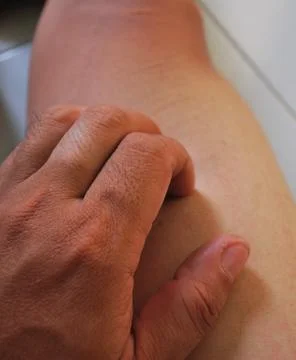 Scratching the leg caused by itching Stock-Fotos